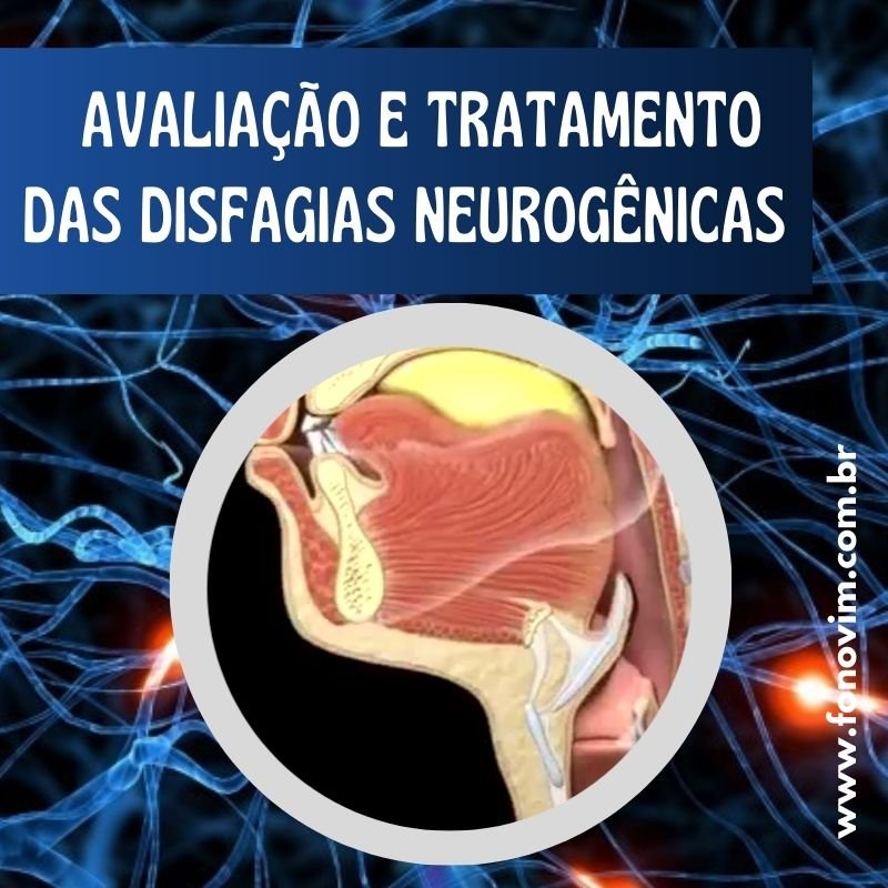 Banner do curso Avaliação e Tratamento das Disfagias Neurogênicas - Versão Gravada