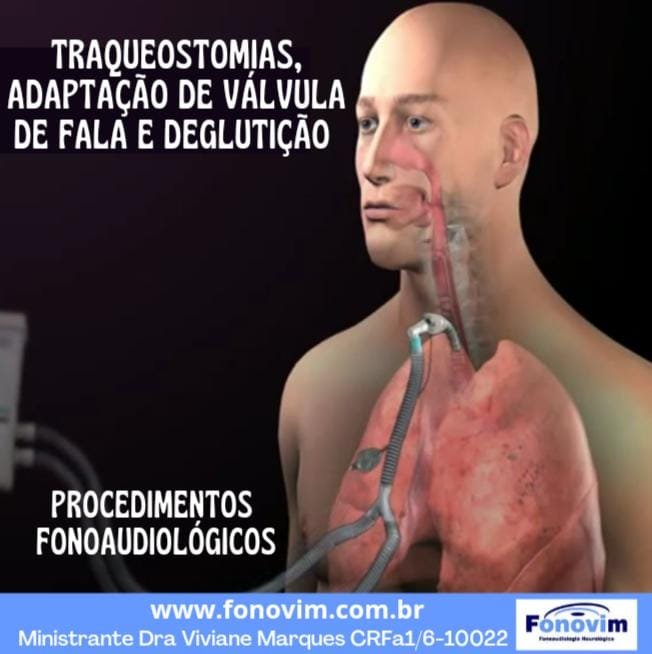 Banner do curso Traqueostomias e Adaptação de Válvula de Fala e Deglutição - Versão Gravada
